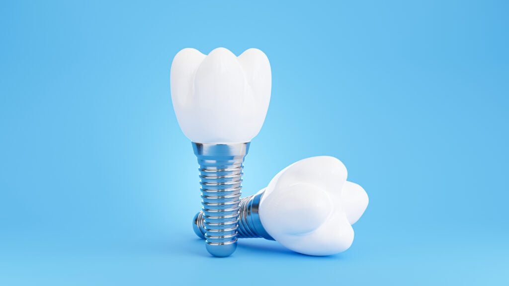 dental implants Sorrento Valley